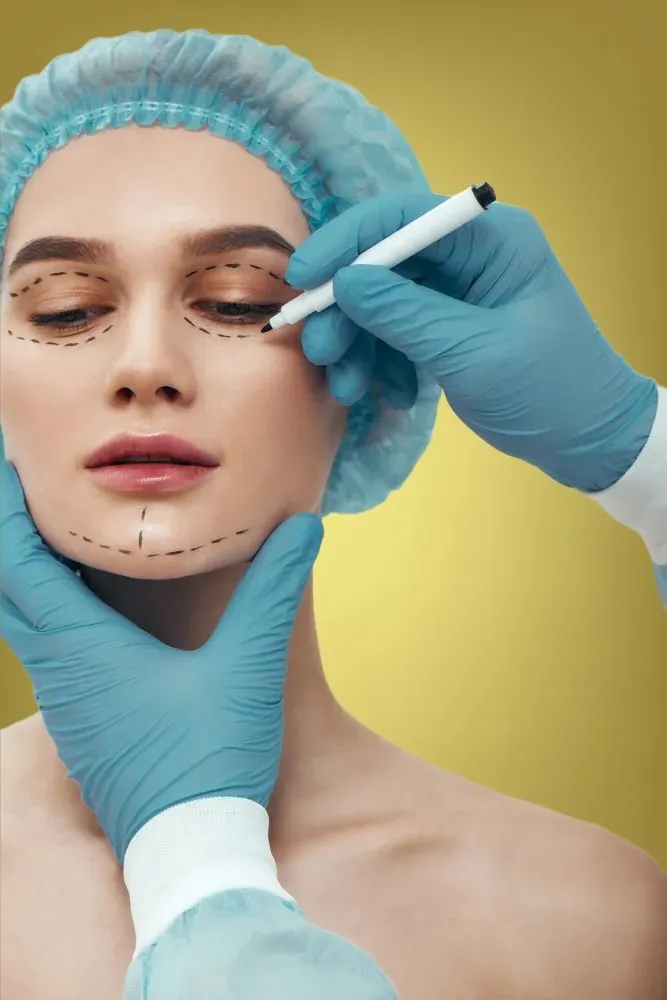 Surgical facial contouring and septorhinoplasty result at Cosmo Radiance Hyderabad Surgical facial contouring and septorhinoplasty result at Cosmo Radiance Hyderabad