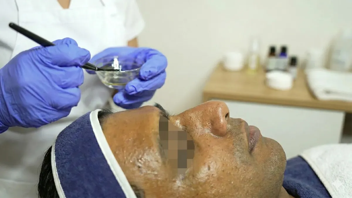 MD Dermatologist performing advanced medical chemical peel treatment at Cosmo Radiance clinic in Hyderabad for skin resurfacing and pigmentation correction