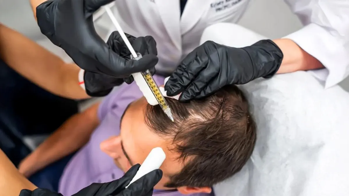 Advanced GFC Hair Treatment in Hyderabad | GFC Cost & Benefits Advanced GFC Hair Treatment in Hyderabad | GFC Cost & Benefits